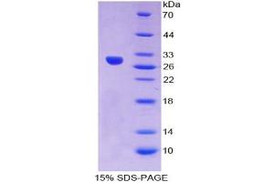 SDS-PAGE analysis of Human Crystallin lambda 1 Protein.