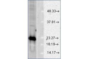 Image no. 2 for anti-Superoxide Dismutase 1, Soluble (SOD1) antibody (ABIN264856) (SOD1 anticorps)
