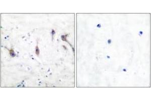 Immunohistochemistry analysis of paraffin-embedded human brain tissue, using ARC Antibody.