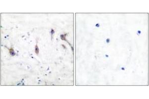 Immunohistochemistry analysis of paraffin-embedded human brain tissue, using ARC Antibody. (ARC (AA 159-208) anticorps)