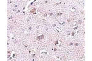 Immunohistochemistry (IHC) image for anti-Cerebral Dopamine Neurotrophic Factor (CDNF) (C-Term) antibody (ABIN1030330)