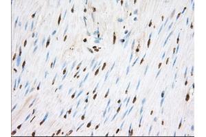 Image no. 1 for anti-Transforming, Acidic Coiled-Coil Containing Protein 3 (TACC3) antibody (ABIN1498097) (TACC3 anticorps)
