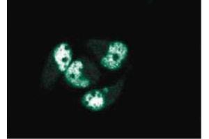 Immunofluorescence staining of AN3 CA cells (Human endometrial adenocarcinoma, ATCC HTB-111). (PCNA anticorps  (AA 68-230))