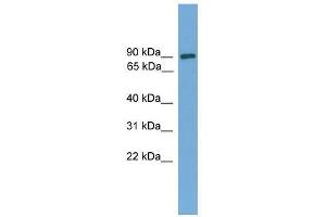 Western Blot showing DEPDC1 antibody used at a concentration of 1-2 ug/ml to detect its target protein. (DEPDC1 anticorps  (Middle Region))