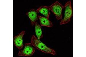 Immunofluorescence analysis of Eca-109 cells using KLF4 monoclonal antibody, clone 1E6  (green) . (KLF4 anticorps)