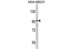 Image no. 1 for anti-Discs, Large (Drosophila) Homolog-Associated Protein 1 (DLGAP1) (N-Term) antibody (ABIN452914)