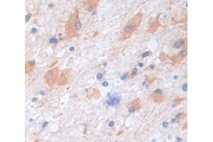 IHC-P analysis of Human Tissue, with DAB staining. (CPE anticorps  (AA 318-476))
