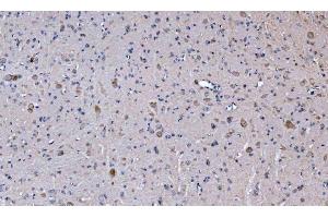 IHC analysis of GLS using anti-GLS antibody (ABIN7601603). (Glutaminase anticorps  (AA 396-654))