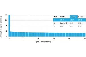 Analysis of Protein Array containing more than 19,000 full-length human proteins using MCAM Mouse Monoclonal Antibody (MCAM/3048).