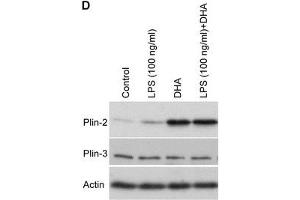Western blot analysis of Plin-2 (ABIN285650) and -3 following treatment of LPS and/or DHA.