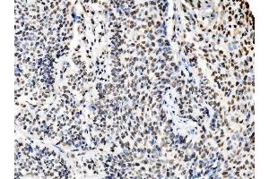 IHC analysis of DBC-1/CCAR2 using anti-DBC-1/CCAR2 antibody (ABIN7602235). (CCAR2 anticorps  (AA 65-917))