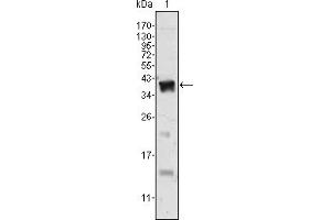 Western blot analysis using Androgen receptor mouse mAb against human recombinant Androgen receptor. (Androgen Receptor anticorps)