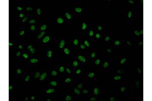 Immunofluorescence staining of Hela Cells with ABIN7127514 at 1:50, counter-stained with DAPI. (Recombinant Geminin anticorps)