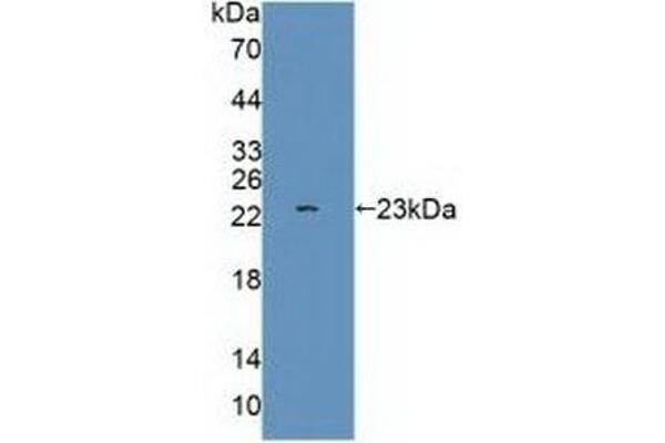 Glutamate Receptor 3 anticorps  (AA 649-823)
