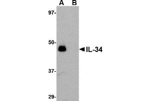 Western blot analysis of IL-34 in human brain tissue lysate with AP30428PU-N IL-34 antibody at 0. (IL-34 anticorps  (N-Term))