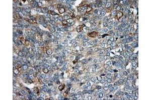 Immunohistochemical staining of paraffin-embedded Kidney tissue using anti-SIL1 mouse monoclonal antibody. (SIL1 anticorps)