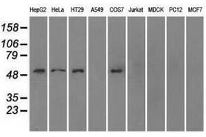 Image no. 2 for anti-Solute Carrier Family 2 (Facilitated Glucose/fructose Transporter), Member 5 (SLC2A5) antibody (ABIN1498479) (SLC2A5 anticorps)