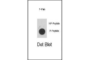 Dot blot analysis of anti-Phospho-PKK2- Antibody 3147a on nitrocellulose membrane.