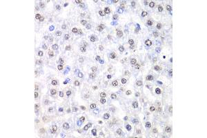 Immunohistochemistry of paraffin-embedded rat liver using Nono Antibody (ABIN5973035) at dilution of 1/100 (40x lens). (NONO anticorps)
