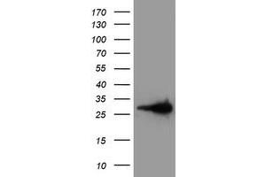 Western Blotting (WB) image for anti-Latexin (LXN) antibody (ABIN1499099) (Latexin anticorps)