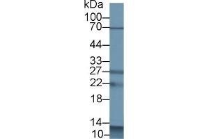 Detection of S100A12 in Porcine Spleen lysate using Polyclonal Antibody to S100 Calcium Binding Protein A12 (S100A12) (S100A12 anticorps  (AA 2-92))