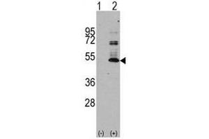 Image no. 1 for anti-Microtubule-Associated Protein tau (MAPT) antibody (ABIN356907) (MAPT anticorps)