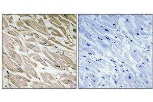 Immunohistochemistry analysis of paraffin-embedded human heart tissue using PPP1R2 (Phospho-Ser120+Ser121) antibody.