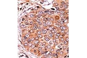Image no. 2 for anti-SMAD, Mothers Against DPP Homolog 3 (SMAD3) (pSer208) antibody (ABIN358225) (SMAD3 anticorps  (pSer208))