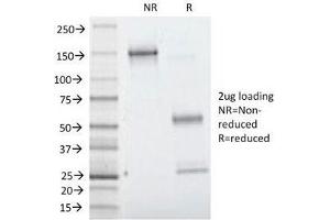 SDS-PAGE Analysis of Purified, BSA-Free Villin Antibody (clone VIL1/1314).