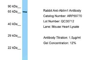 Western Blotting (WB) image for anti-Actin Binding LIM Protein 1 (ABLIM1) (Middle Region) antibody (ABIN2788205) (ABLIM1 anticorps  (Middle Region))