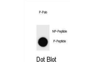 Dot blot analysis of Phospho-IKKB- Antibody Phospho-specific Pab (ABIN1539710 and ABIN2839875) on nitrocellulose membrane.