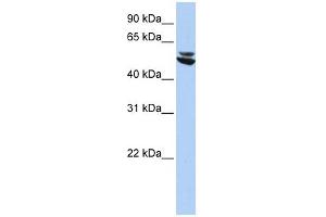 Cytokeratin 7 antibody used at 1 ug/ml to detect target protein. (Cytokeratin 7 anticorps  (N-Term))