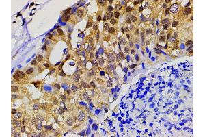 ABIN6277691 at 1/200 staining human gastric tissue sections by IHC-P. (Ephrin B2 anticorps  (C-Term))