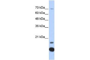 WB Suggested Anti-TXN2 Antibody Titration: 0. (TXN2 anticorps  (Middle Region))