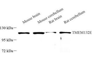 Western blot analysis of TMEM132E (ABIN7075991) at dilution of 1: 250 (TMEM132E anticorps)