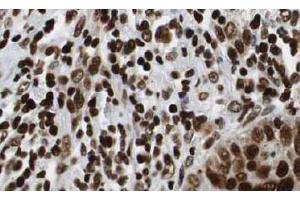 Image no. 3 for anti-Histone Deacetylase 1 (HDAC1) (AA 466-482) antibody (ABIN401309) (HDAC1 anticorps  (AA 466-482))