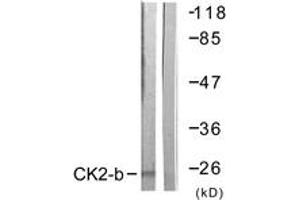 Western blot analysis of extracts from HuvEc cells, using CKII-beta (Ab-209) Antibody. (CSNK2B anticorps  (AA 166-215))
