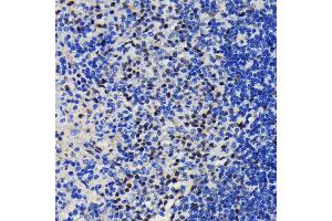 Immunohistochemistry of paraffin-embedded rat spleen using K/TRIM28 antibody (ABIN7270986) at dilution of 1:100 (40x lens). (KAP1 anticorps)