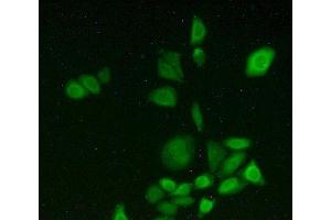 Detection of CYP1A2 in Hela cells using Polyclonal Antibody to Cytochrome P450 1A2 (CYP1A2)