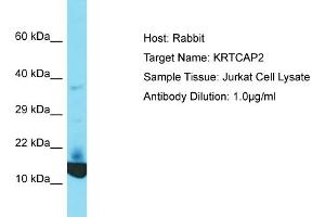 Host: Rabbit Target Name: KRTCAP2 Sample Tissue: Human Jurkat Whole Cell Antibody Dilution: 1ug/ml (KRTCAP2 anticorps  (C-Term))