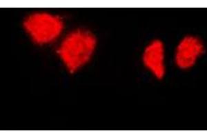 Immunofluorescent analysis of HSP40 staining in HeLa cells. (DNAJB1 anticorps  (C-Term))