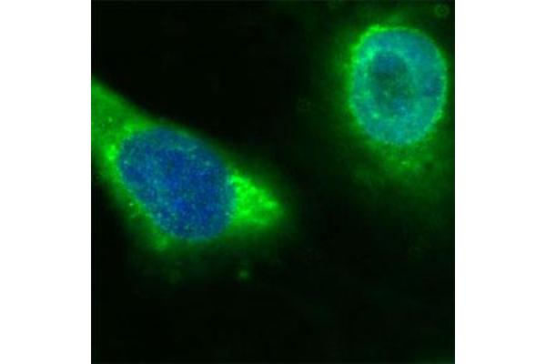 CD36 Antikörper  (Extracellular Domain)