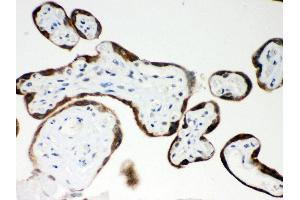 Immunohistochemistry (Paraffin-embedded Sections) (IHC (p)) image for anti-Pregnancy-Associated Plasma Protein A, Pappalysin 1 (PAPPA) (AA 95-388) antibody (ABIN3043377) (PAPPA anticorps  (AA 95-388))