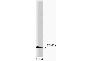 Western blot analysis of RBP on MDCK lysate. (RBP4 anticorps  (AA 1-135))