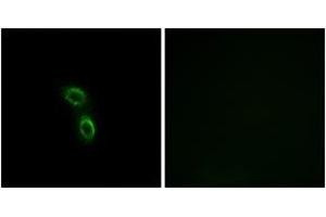 Immunofluorescence analysis of A549 cells, using ARMC6 Antibody. (ARMC6 anticorps  (AA 431-480))