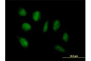 Immunofluorescence of purified MaxPab antibody to ADAMTSL4 on HeLa cell. (ADAMTSL4 anticorps  (AA 1-424))
