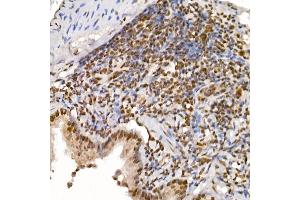 Immunohistochemistry of paraffin-embedded rat lung using T Rabbit mAb (ABIN7270715) at dilution of 1:25 (40x lens).