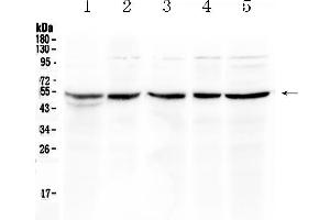 Western blot analysis of EIF3e using anti- EIF3e antibody . (EIF3E anticorps  (AA 160-241))