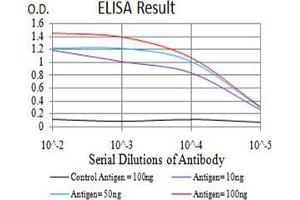 Black line: Control Antigen (100 ng);Purple line: Antigen (10ng); Blue line: Antigen (50 ng); Red line:Antigen (100 ng)