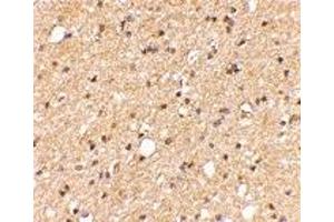 Immunohistochemistry (IHC) image for anti-Leucine-Rich Repeat LGI Family, Member 2 (LGI2) (Middle Region) antibody (ABIN1030982) (LGI2 anticorps  (Middle Region))